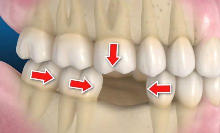 Probleme funcționale și estetice