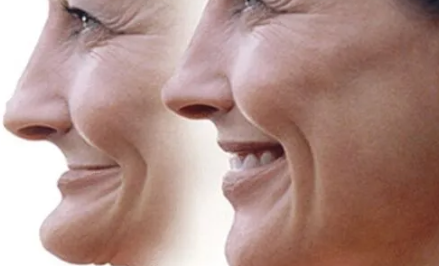 Modificări ale formei feței